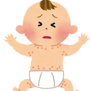 「乳児脂漏性湿疹」赤ちゃんの頭皮が乾燥でカサカサ！かさぶたになる原因は？正しいケアとは