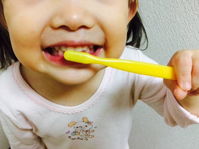 赤ちゃんの頃から始める虫歯予防!きれいな乳歯を守るために出来ることとは